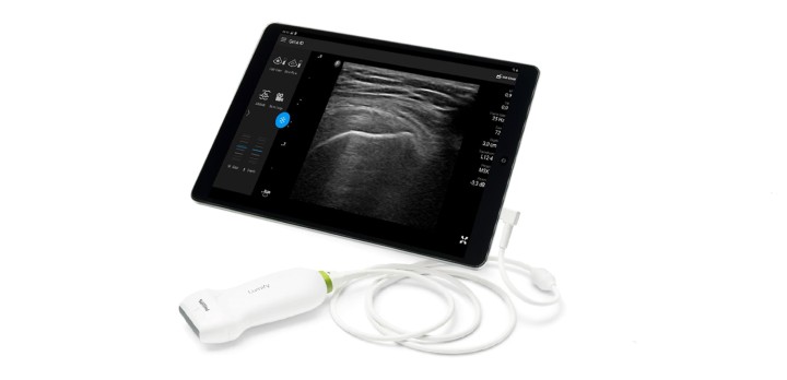 Hier siehen Sie das Produkt Philips Lumify Ultraschall-Diagnostik aus der Kategorie Therapiegeräte/PiezoWave2.
