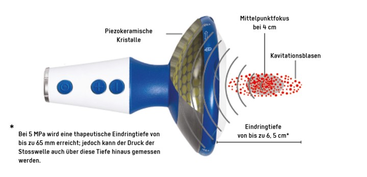 Hier sehen Sie das Produkt Swiss PIEZOCLAST aus der Kategorie Guides DolorClast® Therapie